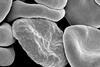 Red_blood_cells_infected_with_malaria
