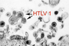HTLV-1
