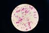Nontuberculous_Mycobacteria_(NTM)_in_Ziehl-Neelsen_Staining_from_Positive_MGIT_Culture