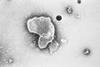 Respiratory Syncytial Virus (RSV)