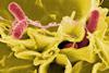 Salmonella_Bacteria_(5613656967)