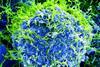 Ebola_Virus_-_Electron_Micrograph.tiff