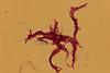 Serpentine_cords_of_red-stained,_acid-fast_structure_in_a_Ziehl-Neelsen_stained_smear_of_Mycobacterium_tuberculosis_complex_(MTBC)_from_liquid_culture