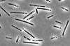 Clostridium_perfringens_sporulating