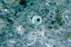 Entamoeba_histolytica_01