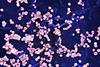 Lassa_Virus_-_51692120370
