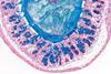 Low-Res_coupe_colon_HD