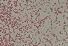 Gram_-negative_cocci_(GNC)_and_Gram_-negative_rod_(GNR)_of_Acinetobactet_baumannii_in_Gram_staining