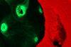 Low-Res_Black Band Disease under the fluorescence microscope_Credit_D’Angelo and Wiedenmann_University of Southampton
