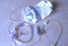 PIC_0007_gastrostomie