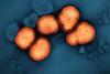 Influenza_A_Virus_(H3N2)_(52747106987)