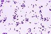 Gram_stain_of_Streptococcus_pneumoniae