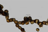 Low-Res_melanized hyphae developing into chlamydospores(1)