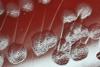 Pseudomonas_aeruginosa_colony_morphology_on_blood_agar