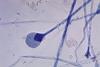 Mature sporangium of a Mucor sp. fungus