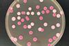 Low-Res_Figure 2-Colony morphologies of Candida tropicalis