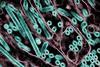 H5N1_Avian_Influenza_A_Virus