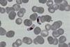 P.falciparum-gametocytes