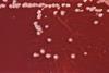 Pseudomonas_aeruginosa_01