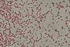 Gram_-negative_cocci_(GNC)_and_Gram_-negative_rod_(GNR)_of_Acinetobactet_baumannii_in_Gram_staining (2)