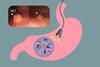 Low-Res_Otani-image