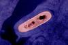 Listeria_Bacterium_02