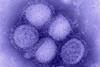H1N1_influenza_virus