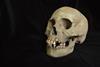 The skull of a 9-11 year old girl