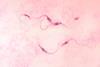 Trypanosoma_cruzi_crithidia