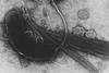 735px-Vibrio_cholerae (2)