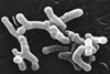 Bifidobacterium_longum_en_microscopie_électronique