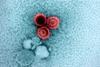 Epstein-Barr_Virus_(EBV)_Particles_-_53583885254
