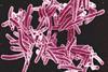 Mycobacterium_tuberculosis_Bacteria,_the_Cause_of_TB_(5149398656)