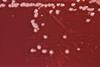 Pseudomonas_aeruginosa_01