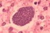 Histopathology_of_malaria_exoerythrocytic_forms_in_liver_07G0024_lores (1)