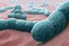 960px-Streptococcus_pneumoniae_-_A_causative_bacteria_of_meningitis