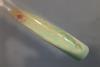 Mycobacterium_tuberculosis_growth_on_L-J_medium (1)