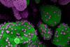 Novel_Coronavirus_SARS-Cov-2_(50011008502)