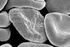 Red_blood_cells_infected_with_malaria