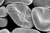 Red_blood_cells_infected_with_malaria
