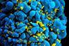 HIV-infected_T_cell_(6813384933)