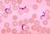 Trypanosoma_sp._PHIL_613_lores