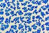 Saccharomyces_cerevisiae_Loeffler's_Methylene_Blue_Staining