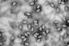 Phage_de_S_aureus_3A
