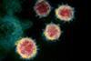 Novel_Coronavirus_SARS-CoV-2 (2)