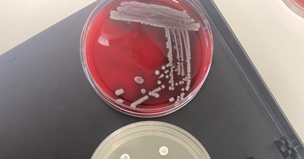 Scientists reveal search for faster way to diagnose MRSA and its ...