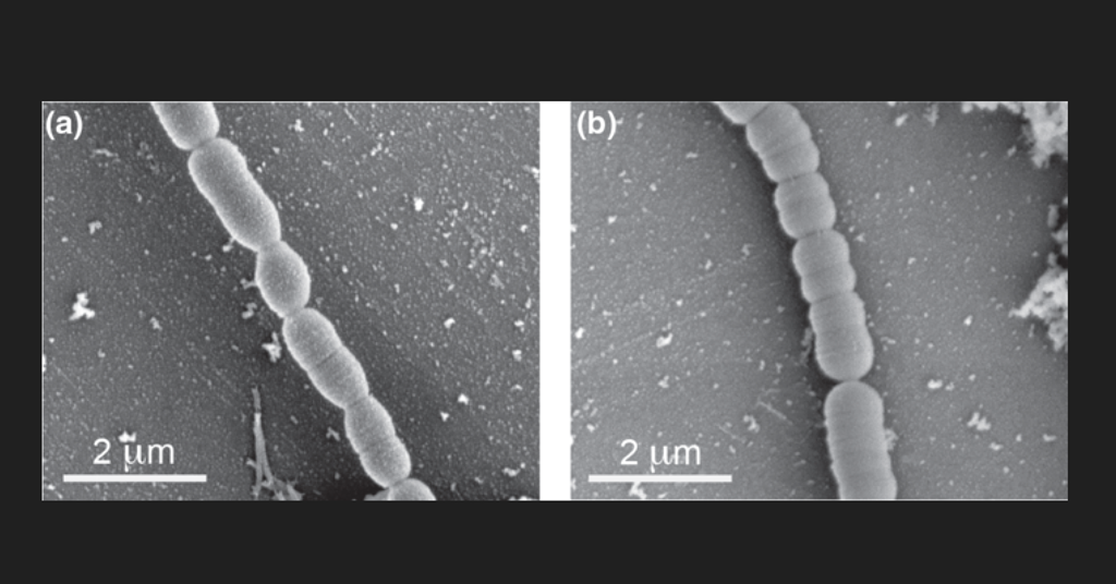 Two New Bacterial Species Identified From Patients With Inflammatory   1270 Screenshot20230113102157 367250 