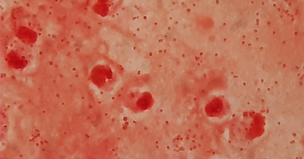 Image via the-microbiologist.com