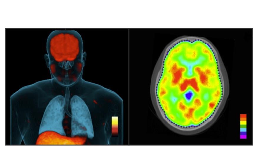 FDA approved TB Regimen May Not Work Against Deadliest Form Of TB The fda-approved-tb-regimen-may-not-work-against-deadliest-form-of-tb-the