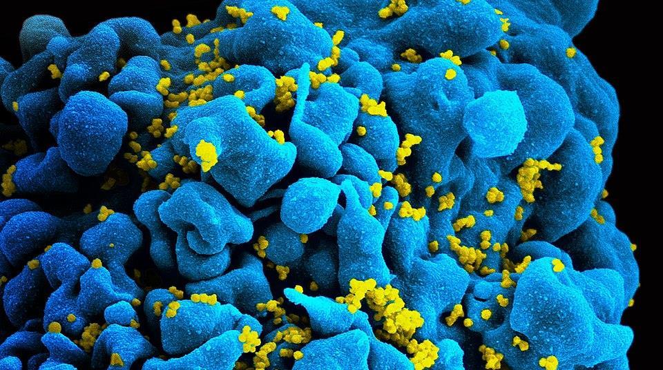 U.S. Public Health Service releases new guidelines on occupational HIV ...